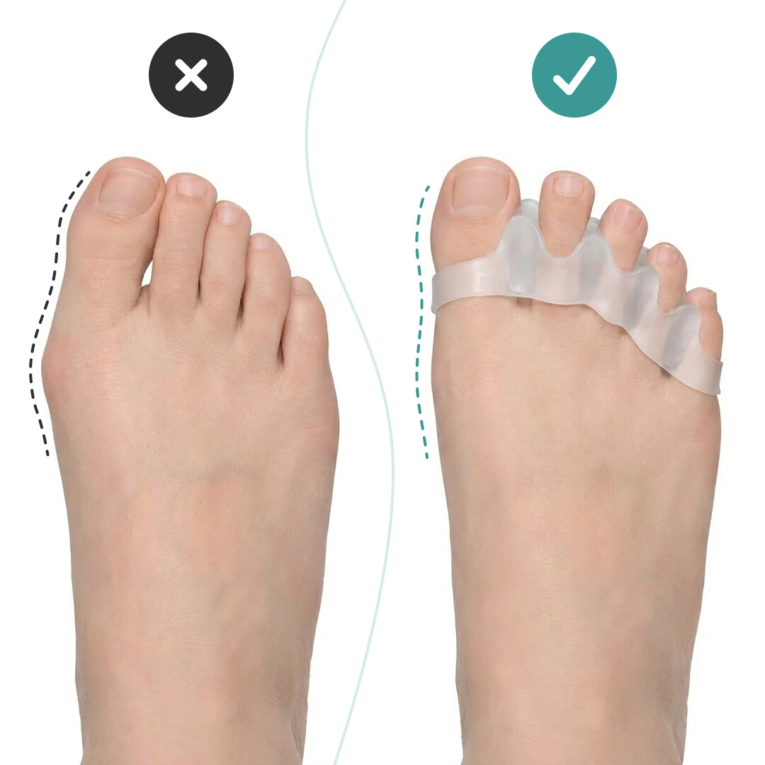 OrthoRelax® – Separatore per Dita in Gel (2 separatori) - immagine 2