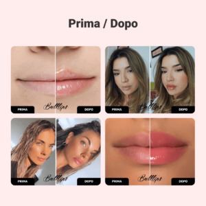 Alternative view of BULKLIPS Plumper Set per Labbra allo Zenzero e Menta