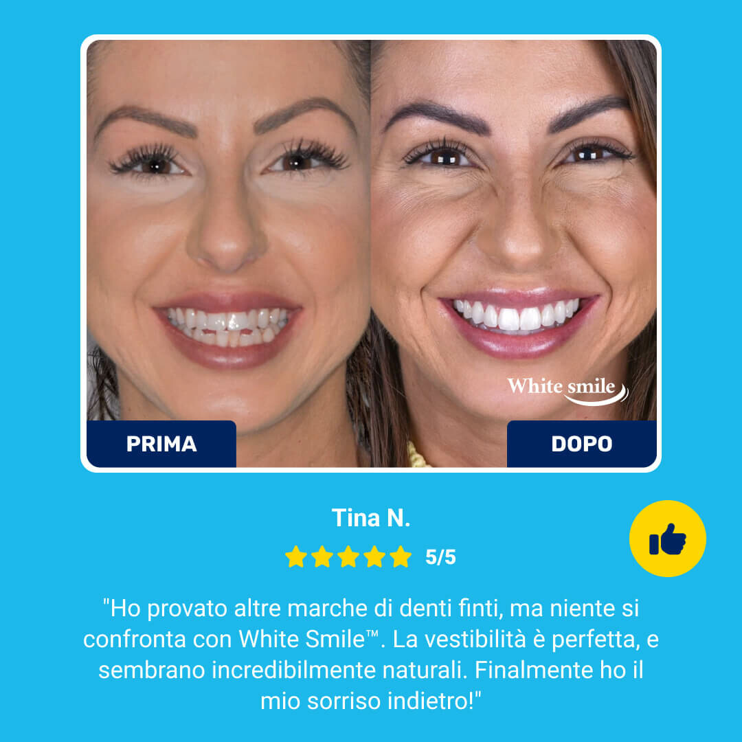 WHITESMILE™ – Faccetta Dentale Cosmetica Regolabile - immagine 8